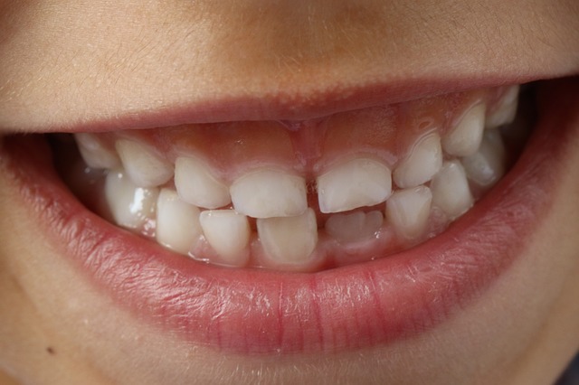 teeth-1743981_640